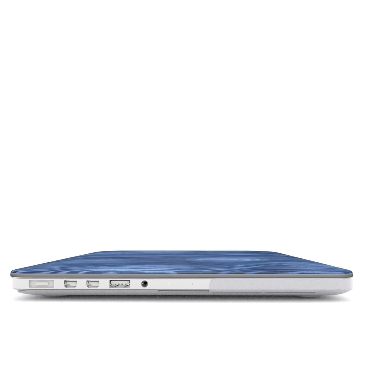 MacBook snap case: Enchanted Forrest