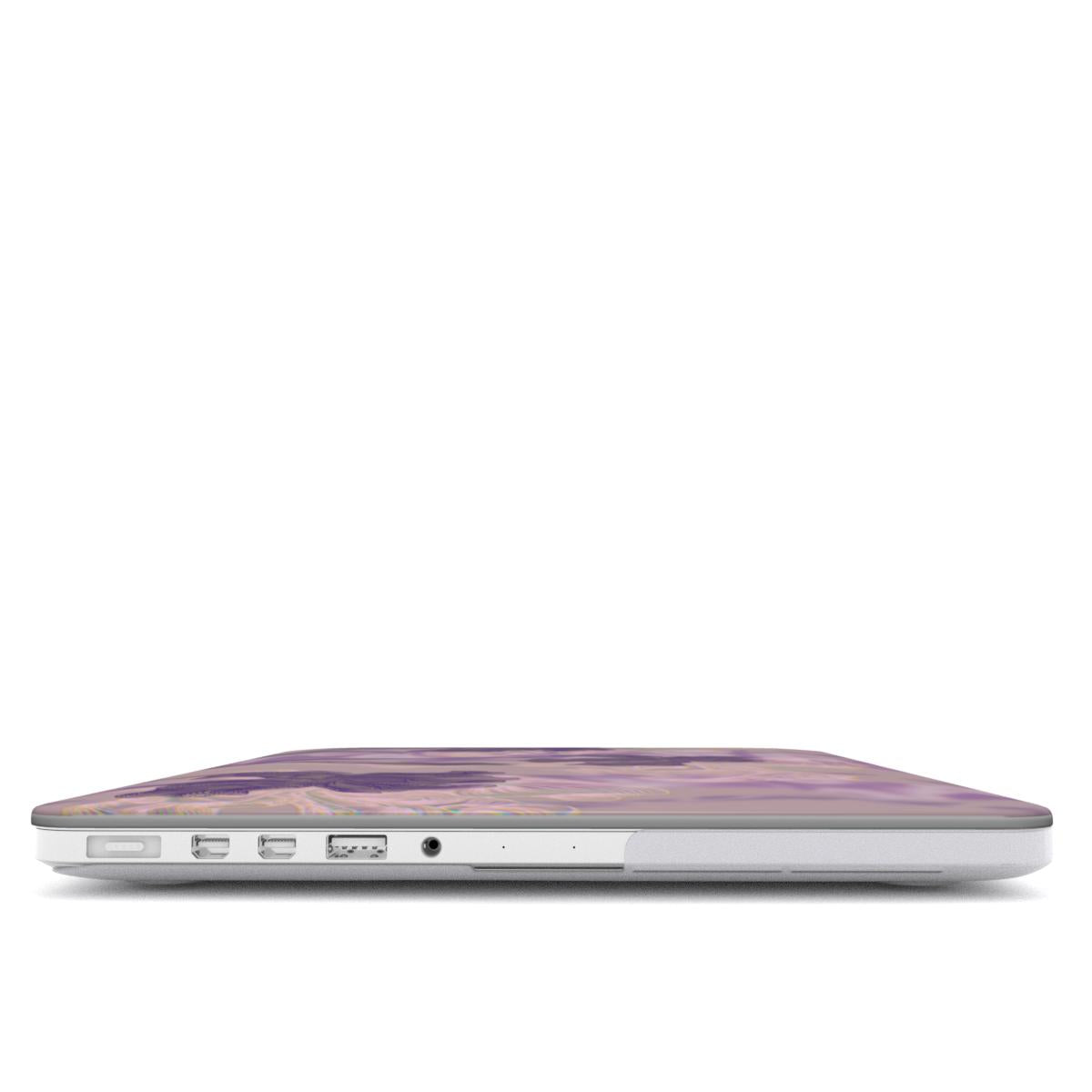MacBook snap case: The Iris of Your Eye